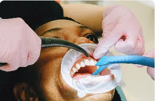 Professional teeth cleaning and whitening