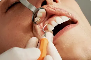 Dental scaling procedure in Bangalore