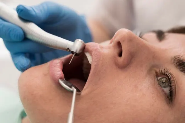 Root canal treatment in Vasanth Nagar, Bangalore