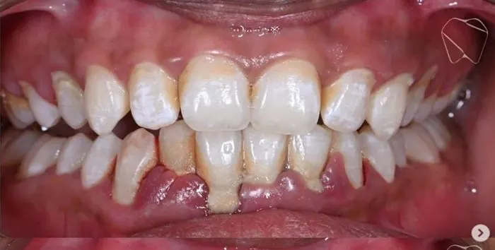 Restorative dental treatment - before treatment