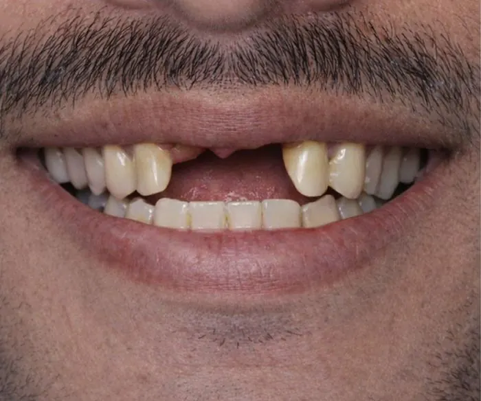 Cosmetic dental treatment - before treatment
